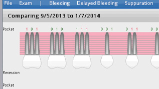 dental practice analytics amp cloud software solution voice activated periodontal charting